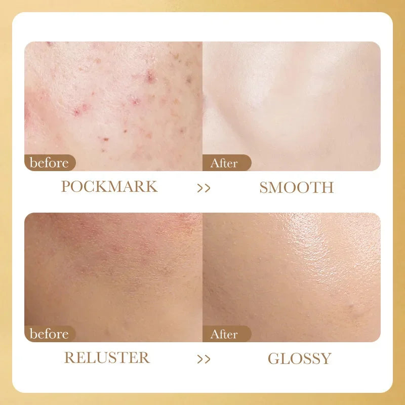 Face Serum Niacinamide Whitening  Freeze-Dried Podwer Set Shrink Pores Hydrating Brighten Anti-Aging Anti Wrinkle Skin Care jjihguhjhfdhguudf