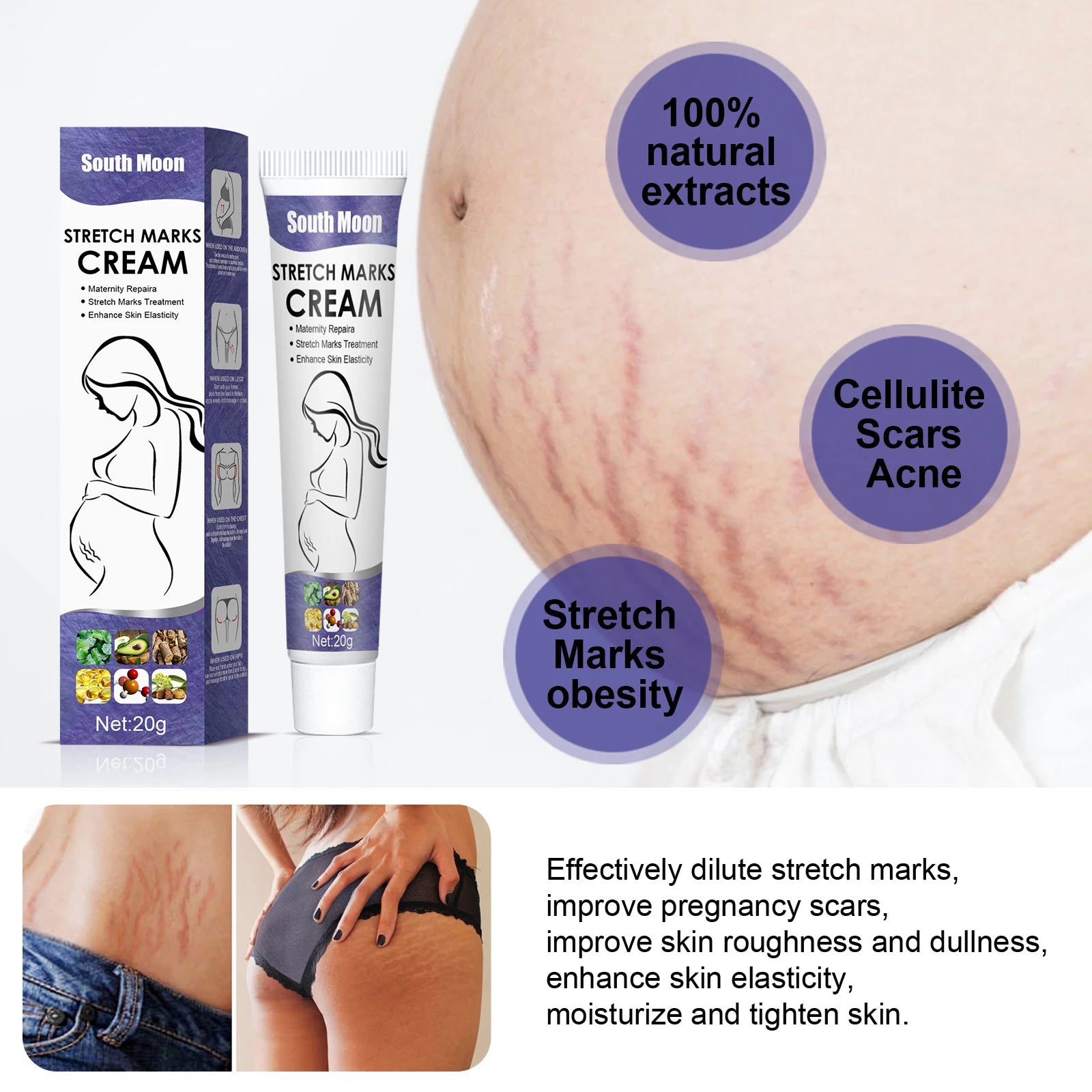Remove Pregna ncy Stretch Marks Cream Improves Elasticity Fade Growth Lines Smoothing Nourishing Moisturizing Firming Skin Care 2